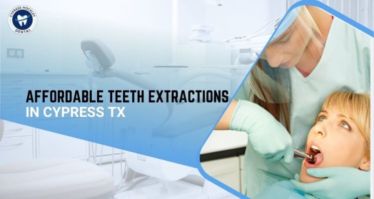 Affordable Teeth Extractions in Cypress TX