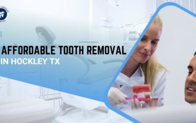 Affordable Tooth Removal in Hockley TX