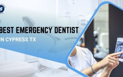 Best Emergency Dentist in Cypress TX