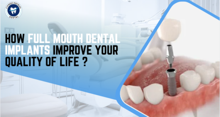 full mouth dental implants