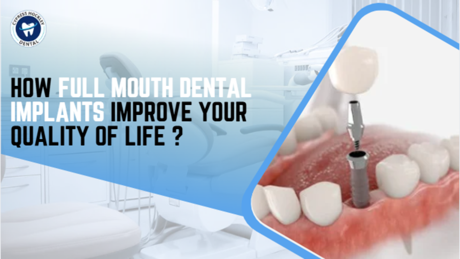 full mouth dental implants