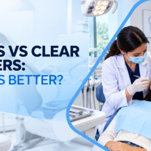 Braces vs Clear Aligners: Which Is Better?