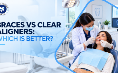 Braces vs Clear Aligners: Which Is Better?