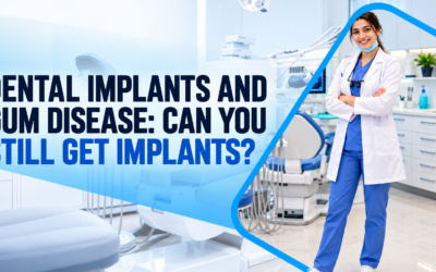 Dental Implants and Gum Disease: Can You Still Get Implants?